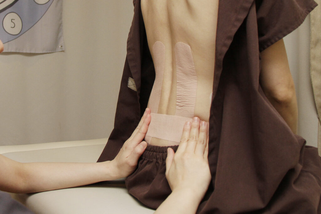 施術について07-キネシオテーピング02